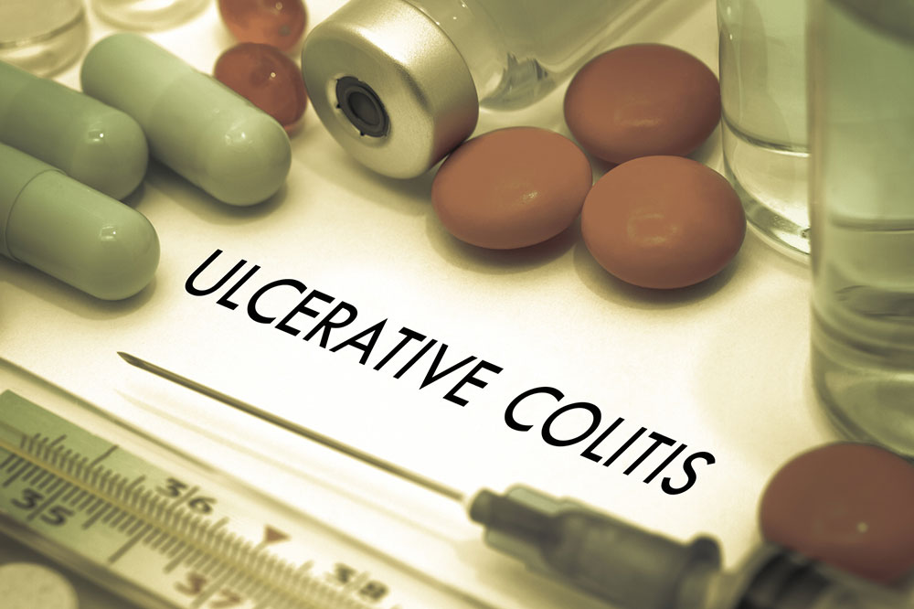 Ulcerative colitis signs, causes, and how to manage it