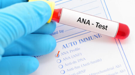 A short guide to antinuclear antibody test