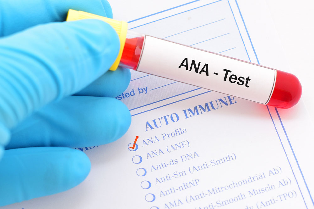 A short guide to antinuclear antibody test