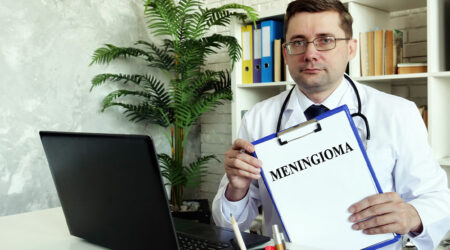 Meningioma &#8211; Causes, top symptoms, and management