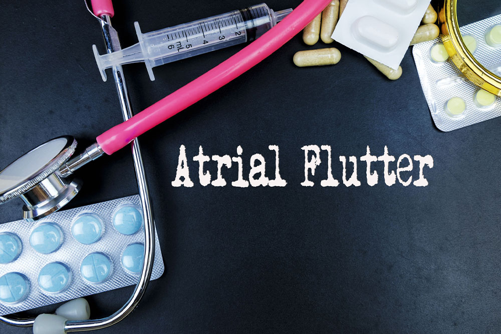 Atrial flutter &#8211; Types, symptoms, causes, and diagnosis