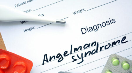 Angelman syndrome &#8211; Causes, symptoms, and management