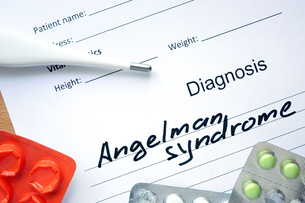 Angelman syndrome &#8211; Causes, symptoms, and management