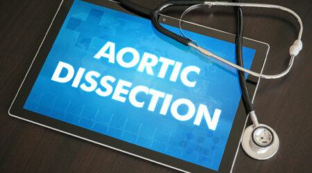 Aortic dissection &#8211; What it is and its management