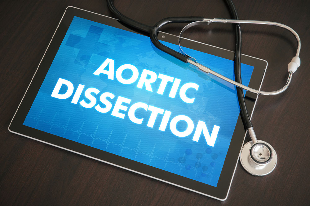 Aortic dissection &#8211; What it is and its management