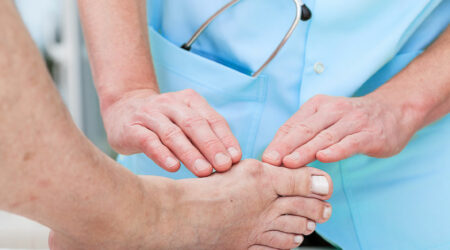 Bunion surgery &#8211; Types, cost, recovery, and more