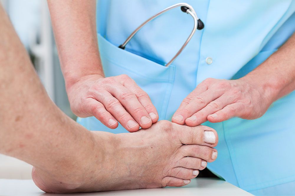 Bunion surgery &#8211; Types, cost, recovery, and more