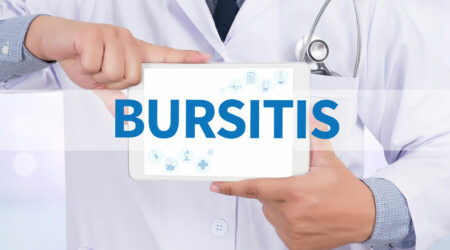 Bursitis &#8211; Causes, symptoms, and preventive measures