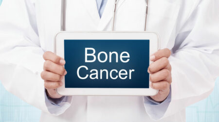 Bone cancer &#8211; Causes, warning signs, and management