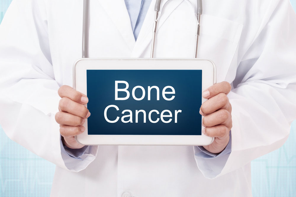 Bone cancer &#8211; Causes, warning signs, and management