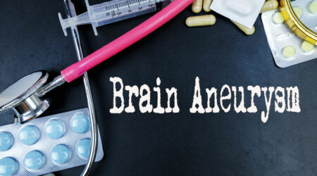 Brain aneurysm &#8211; Causes, symptoms, and management options