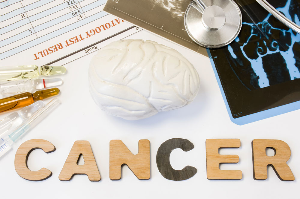 Brain cancer &#8211; Causes, symptoms, and management