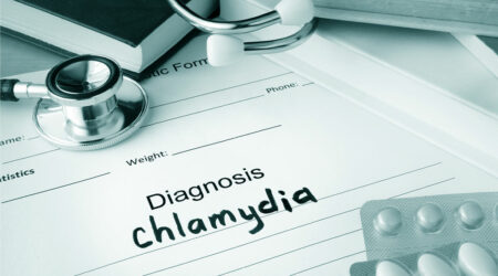 Chlamydia &#8211; Symptoms, causes, and management