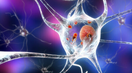 Common neurological disorders and top causes