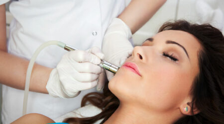 Guide to laser resurfacing for acne scars