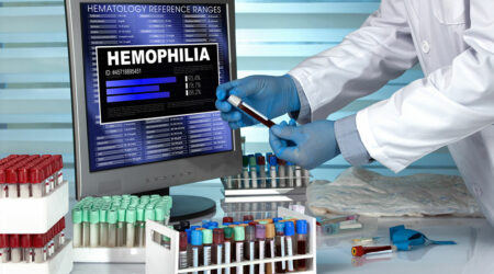 Hemophilia &#8211; Its symptoms, causes, and management