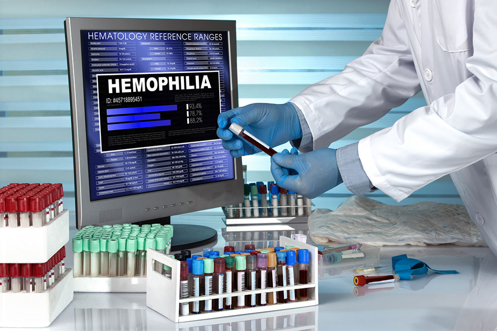 Hemophilia &#8211; Its symptoms, causes, and management