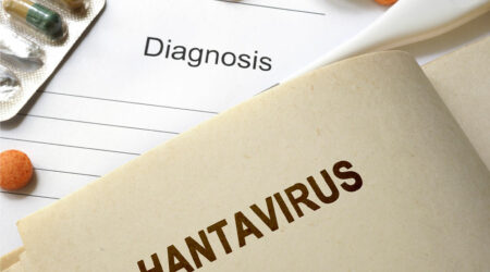 Important aspects to know about the hantavirus pulmonary syndrome