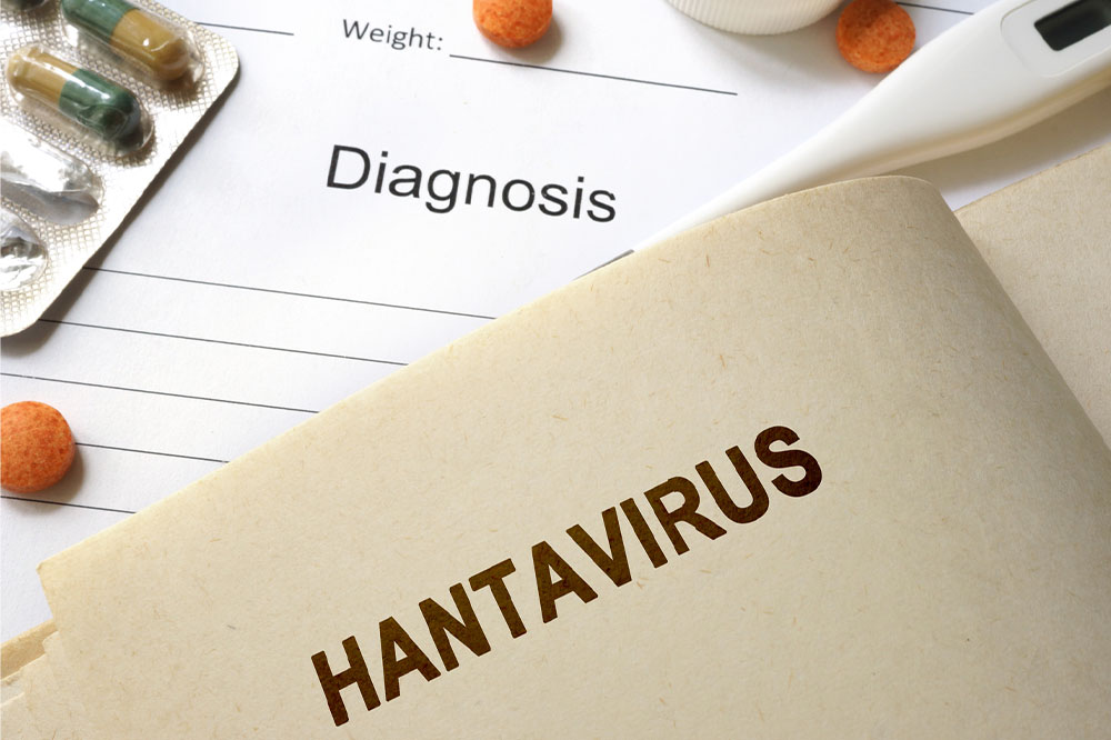 Important aspects to know about the hantavirus pulmonary syndrome