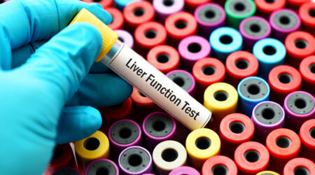 Liver function tests &#8211; Purpose, types, and procedure