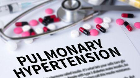 Pulmonary hypertension &#8211; Types, symptoms, and causes