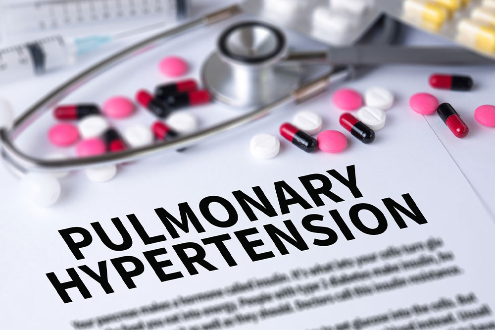 Pulmonary hypertension &#8211; Types, symptoms, and causes