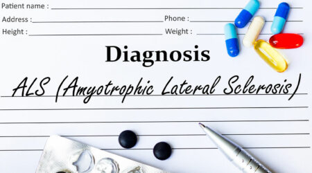 Understanding amyotrophic lateral sclerosis and its impact