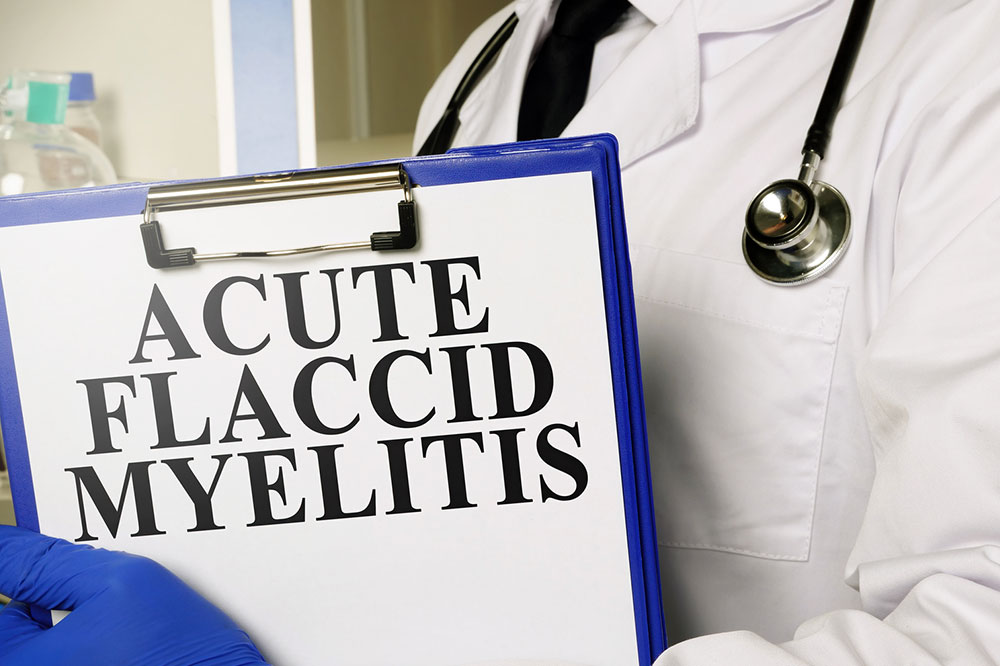 Acute flaccid myelitis &#8211; Signs, causes, diagnosis , and more