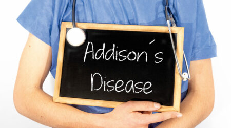 Addison&#8217;s disease &#8211; Symptoms, causes, and management