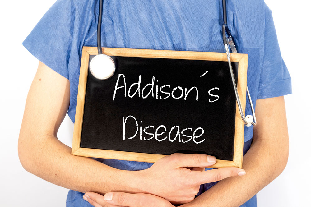 Addison&#8217;s disease &#8211; Symptoms, causes, and management