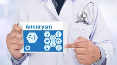 Aneurysm &#8211; Types, symptoms, and management