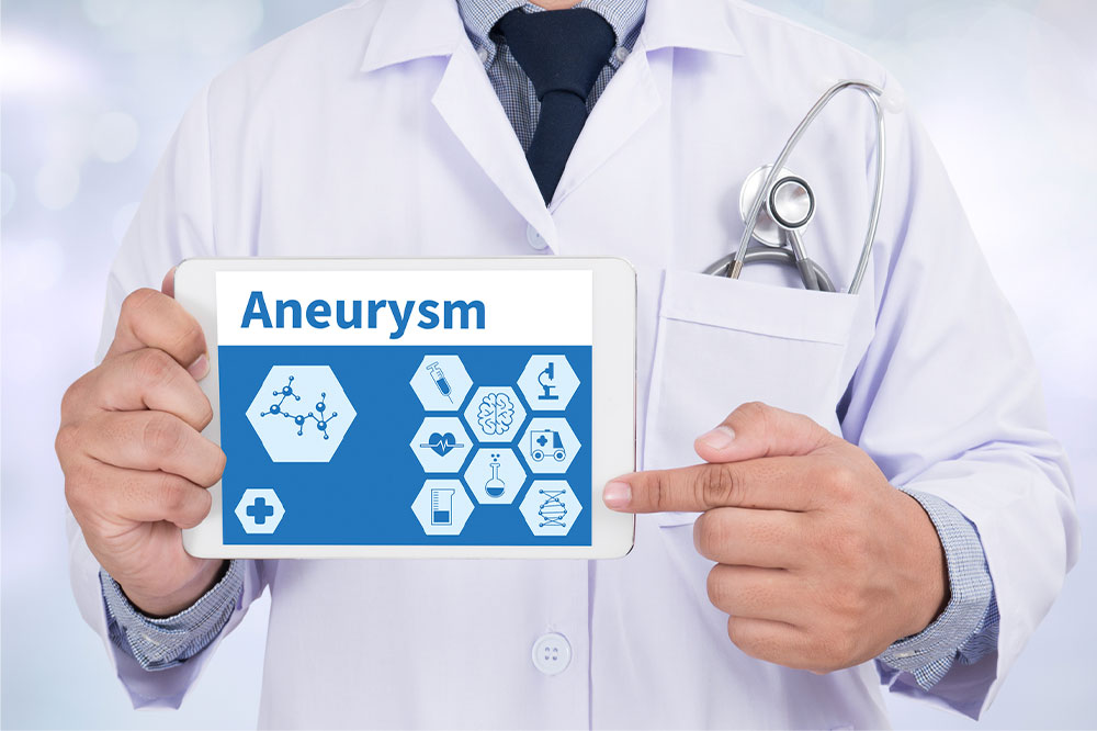 Aneurysm &#8211; Types, symptoms, and management