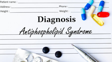 Antiphospholipid syndrome &#8211; Signs, causes, diagnosis, and more